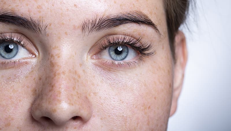 Understanding lasik istanbul: Benefits, Process, and Considerations