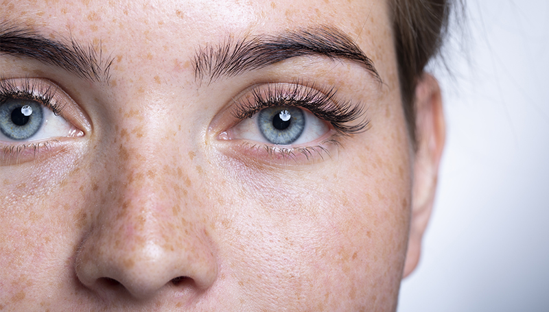 Understanding lasik istanbul: Benefits, Process, and Considerations