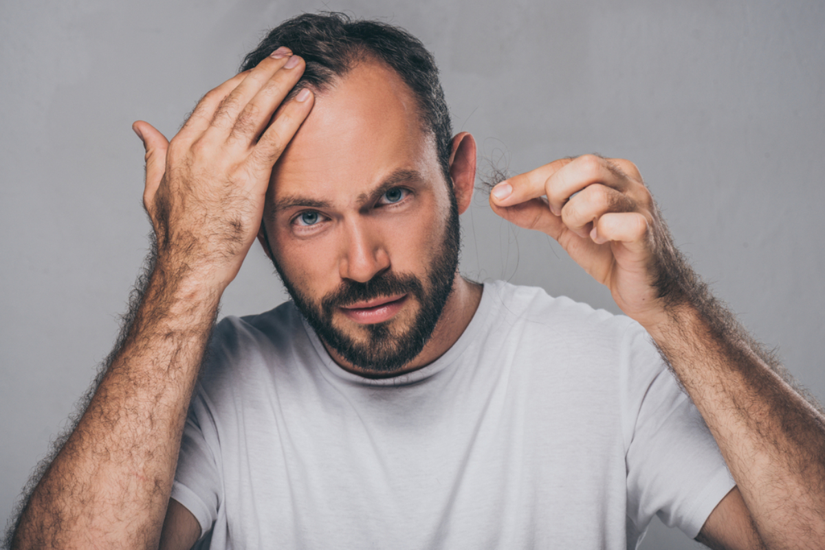 Hair Transplant London Experts – Harley Street Excellence