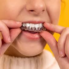 Everything You Need to Know About Ceramic Braces