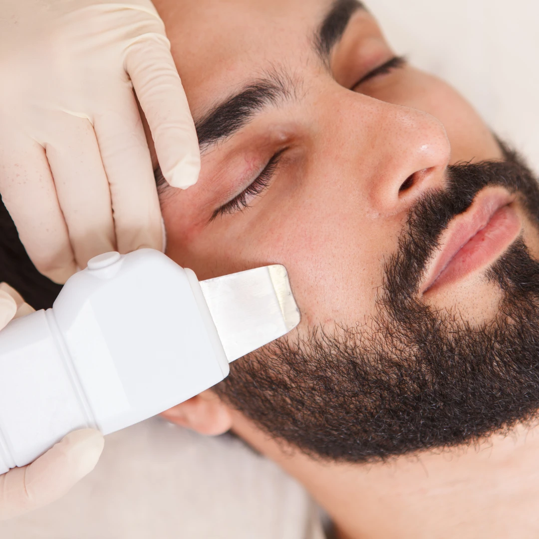 Acne Treatment Facial Near Me – Targeted Care for Breakout-Prone Skin